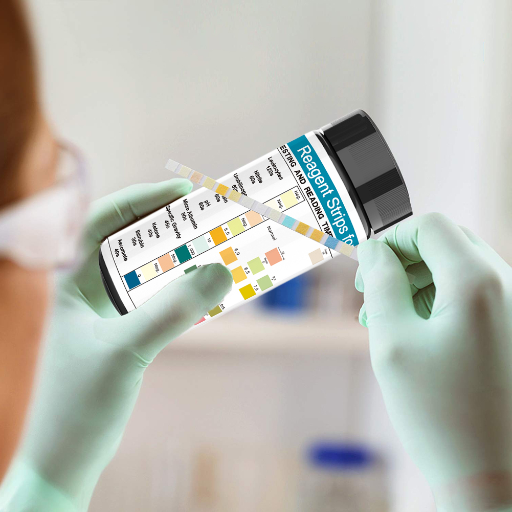 Tiras de prueba de orina, 10 p - Urinalysis Reagent Strip reseña y precio